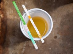 Businesses are Dropping Cannabis Drug Testing for new Employees urinetest