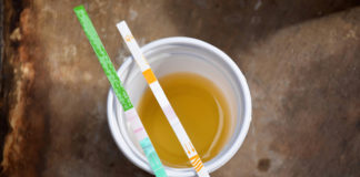 Businesses are Dropping Cannabis Drug Testing for new Employees urinetest