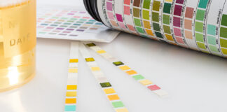 National Pre-Employment Drug Screening Is in Decline Test tires with test chart and urine can